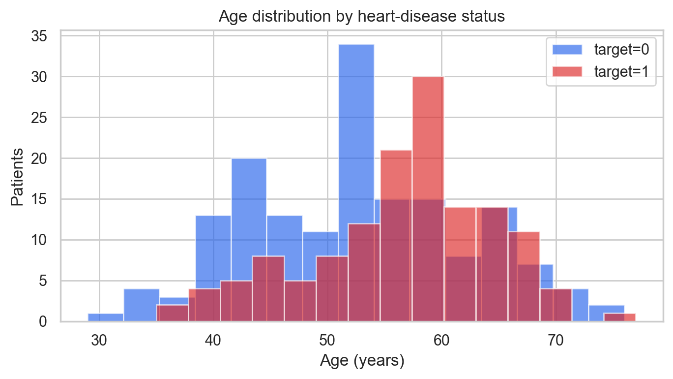 Overlapping histograms of age by heart-disease status. Ages run from 29 to 77. The disease group is more concentrated in the late fifties, while the no-disease group has more patients in the early fifties and forties.